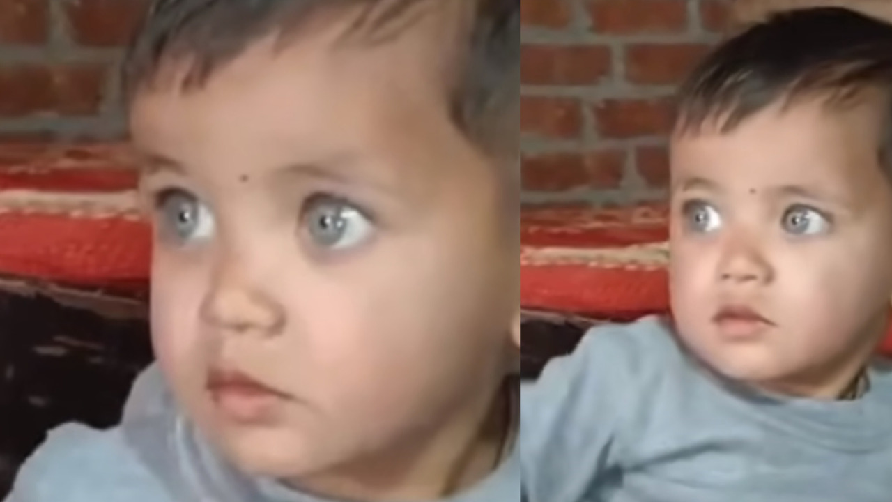 Child with Changing Eye Color